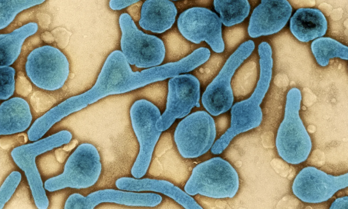 Những điều cần biết về virus Marburg gây bệnh sốt xuất huyết