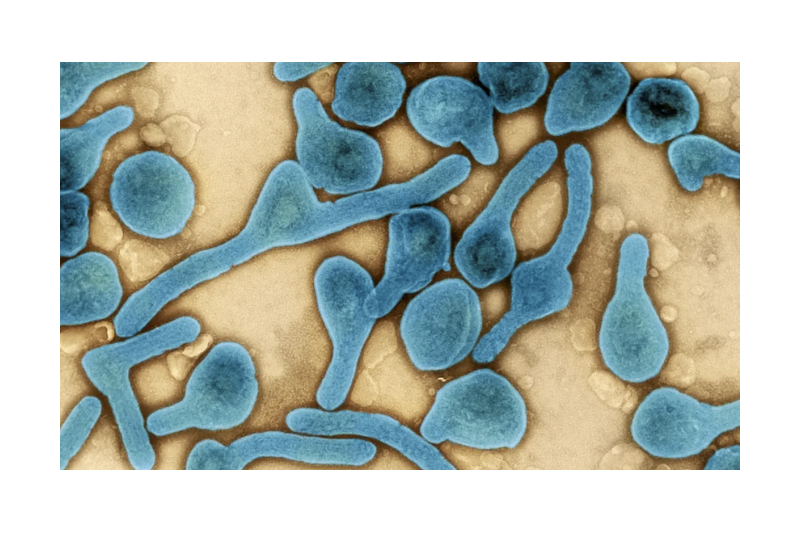 Những điều cần biết về virus Marburg gây bệnh sốt xuất huyết